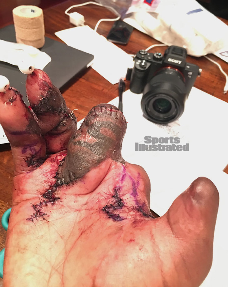 Jason-Pierre-Paul-hand-IMG_7078.jpg